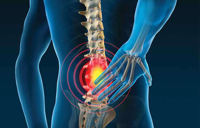 Chronic Low Back Pain Case Study