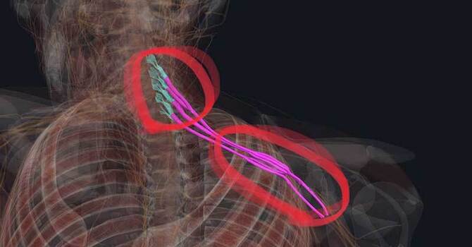 The Nerve Problem You Didn’t Know You Had image